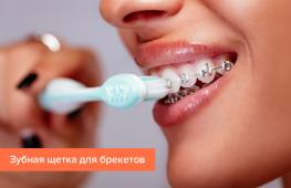 Правильный уход за брекетами и зубами Как правильно чистить зубы если стоят брекеты